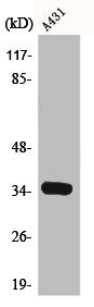 Western Blot analysis of A431 cells using Cdk2/Cdc2 Polyclonal Antibody