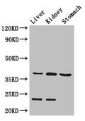 Western Blot
Positive WB detected in: Mouse liver tissue, Mouse kidney tissue, Mouse stomach tissue
All lanes: Akr1a1 antibody at 2.8ug/ml
Secondary
Goat polyclonal to rabbit IgG at 1/50000 dilution
Predicted band size: 37 kDa
Observed band size: 37, 23 kDa