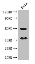 Western Blot
Positive WB detected in: Hela whole cell lysate
All lanes: AKR1B1 antibody at 3ug/ml
Secondary
Goat polyclonal to rabbit IgG at 1/50000 dilution
Predicted band size: 36 kDa
Observed band size: 36, 50 kDa