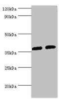 Western blot
All lanes: AKR1C3 antibody at 8µg/ml
Lane 1: K562 whole cell lysate
Lane 2: Hela whole cell lysate
Secondary
Goat polyclonal to rabbit IgG&nbsp;at 1/10000 dilution
Predicted band size: 37, 24 kDa
Observed band size: 37 kDa