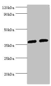 Western blot
All lanes: AKR1C3 antibody at 8µg/ml
Lane 1: K562 whole cell lysate
Lane 2: Hela whole cell lysate
Secondary
Goat polyclonal to rabbit IgG&nbsp;at 1/10000 dilution
Predicted band size: 37, 24 kDa
Observed band size: 37 kDa