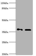 Western blot
All lanes: Aldo-keto reductase family 1 member C4 antibody at 7ug/ml
Lane 1: Hela whole cell lysate
Lane 2: HepG 2 whole cell lysate
Secondary
Goat polyclonal to rabbit IgG at 1/10000 dilution
Predicted band size: 37 kDa
Observed band size: 37 kDa