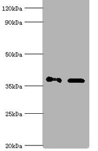 Western blot
All lanes: Aldo-keto reductase family 1 member C4 antibody at 7ug/ml
Lane 1: Hela whole cell lysate
Lane 2: HepG 2 whole cell lysate
Secondary
Goat polyclonal to rabbit IgG at 1/10000 dilution
Predicted band size: 37 kDa
Observed band size: 37 kDa