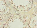 AKR1D1 Antibody, FITC conjugated – Figure 1 of 2