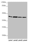 Western blot All lanes: AKR7A2 antibody at 0.88µg/ml Lane 1: Mouse small intestine tissue Lane 2: Mouse liver tissue Lane 3: Mouse gonadal tissue Lane 4: A431 whole cell lysate Secondary Goat polyclonal to rabbit IgG at 1/10000 dilution Predicted band size: 40 kDa Observed band size: 40 kDa