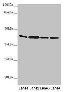 Western blot All lanes: AKR7A2 antibody at 0.88µg/ml Lane 1: Mouse small intestine tissue Lane 2: Mouse liver tissue Lane 3: Mouse gonadal tissue Lane 4: A431 whole cell lysate Secondary Goat polyclonal to rabbit IgG at 1/10000 dilution Predicted band size: 40 kDa Observed band size: 40 kDa