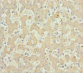 Immunohistochemistry of paraffin-embedded human liver tissue using CSB-PA001550ESR2HU at dilution of 1:100