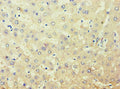 Immunohistochemistry of paraffin-embedded human liver tissue using CSB-PA001551ESR1HU at dilution of 1:100