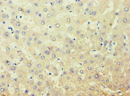 Immunohistochemistry of paraffin-embedded human liver tissue using CSB-PA001551ESR1HU at dilution of 1:100