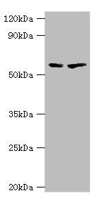 Western blot
All lanes: 5-aminolevulinate synthase, erythroid-specific, mitochondrial antibody at 7ug/ml
Lane 1: 293T whole cell lysate
Lane 2: Mouse brain tissue
Secondary
Goat polyclonal to rabbit IgG at 1/10000 dilution
Predicted band size: 65, 61, 50, 64 kDa
Observed band size: 65 kDa