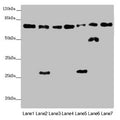 Western blot All lanes: ALB antibody at 2 ug/ml Lane 1: Mouse heart tissue Lane 2: Mouse liver tissue Lane 3: Mouse spleen tissue Lane 4: Mouse lung tissue Lane 5: Mouse kidney tissue Lane 6: Mouse brain tissue Lane 7: Mouse skeletal muscle tissue Secondary Goat polyclonal to rabbit IgG at 1/10000 dilution Predicted band size: 70, 48, 46 kDa Observed band size: 70, 50, 27 kDa
