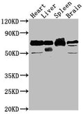 Western Blot
Positive WB detected in: Rat heart tissue, Rat liver tissue, Rat spleen tissue, Rat brain tissue
All lanes: Alb antibody at 1:2000
Secondary
Goat polyclonal to rabbit IgG at 1/50000 dilution
Predicted band size: 69 kDa
Observed band size: 69 kDa