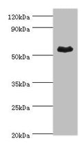 Western blot
All lanes: Retinal dehydrogenase 1 antibody at 4ug/ml + Mouse liver tissue
Secondary
Goat polyclonal to rabbit IgG at 1/10000 dilution
Predicted band size: 55 kDa
Observed band size: 55 kDa
