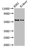 Western Blot
Positive WB detected in: K562 whole cell lysate, Mouse kidney tissue
All lanes: ALDH1A2 antibody at 3.5µg/ml
Secondary
Goat polyclonal to rabbit IgG at 1/50000 dilution
Predicted band size: 57, 54, 55, 47 kDa
Observed band size: 54 kDa