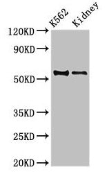 Western Blot
Positive WB detected in: K562 whole cell lysate, Mouse kidney tissue
All lanes: ALDH1A2 antibody at 3.5µg/ml
Secondary
Goat polyclonal to rabbit IgG at 1/50000 dilution
Predicted band size: 57, 54, 55, 47 kDa
Observed band size: 54 kDa