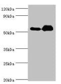 Western blot
All lanes: Retinal dehydrogenase 2 antibody at 9ug/ml
Lane 1: K562 whole cell lysate
Lane 2: Mouse liver tissue
Secondary
Goat polyclonal to rabbit IgG at 1/10000 dilution
Predicted band size: 57, 54, 55, 47 kDa
Observed band size: 57 kDa