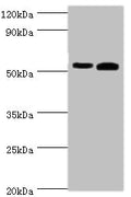 Western blot
All lanes: Retinal dehydrogenase 2 antibody at 14ug/ml
Lane 1: K562 whole cell lysate
Lane 2: Mouse liver tissue
Secondary
Goat polyclonal to rabbit IgG at 1/10000 dilution
Predicted band size: 57, 54, 55, 47 kDa
Observed band size: 57 kDa