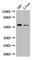 Western Blot
Positive WB detected in: U87 whole cell lysate, Mouse liver tissue
All lanes: ALDH1A3 antibody at 3ug/ml
Secondary
Goat polyclonal to rabbit IgG at 1/50000 dilution
Predicted band size: 57 kDa
Observed band size: 57 kDa