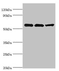 Western blot
All lanes: Aldehyde dehydrogenase X, mitochondrial antibody at 4ug/ml
Lane 1: Hela whole cell lysate
Lane 2: Rat brain tissue
Lane 3: HepG2 whole cell lysate
Secondary
Goat polyclonal to rabbit IgG at 1/10000 dilution
Predicted band size: 57 kDa
Observed band size: 57 kDa