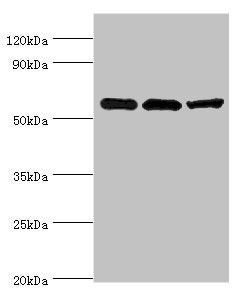 Western blot
All lanes: Aldehyde dehydrogenase X, mitochondrial antibody at 4ug/ml
Lane 1: Hela whole cell lysate
Lane 2: Rat brain tissue
Lane 3: HepG2 whole cell lysate
Secondary
Goat polyclonal to rabbit IgG at 1/10000 dilution
Predicted band size: 57 kDa
Observed band size: 57 kDa