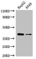 Western Blot
Positive WB detected in: HepG2 whole cell lysate, A549 whole cell lysate
All lanes: AMD1 antibody at 2.5µg/ml
Secondary
Goat polyclonal to rabbit IgG at 1/50000 dilution
Predicted band size: 39, 22 kDa
Observed band size: 39 kDa