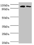 Western blot
All lanes: Cytosolic 10-formyltetrahydrofolate dehydrogenase antibody at 8ug/ml
Lane 1: Mouse liver tissue
Lane 2: Mouse gonad tissue
Secondary
Goat polyclonal to rabbit IgG at 1/10000 dilution
Predicted band size: 99, 88, 100, 56 kDa
Observed band size: 99 kDa