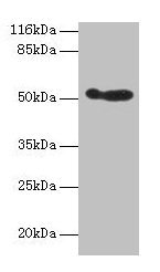 Western blot
All lanes: ALDH3A1 antibody at 2µg/ml + 293T whole cell lysate
Secondary
Goat polyclonal to rabbit IgG at 1/10000 dilution
Predicted band size: 51 kDa
Observed band size: 51 kDa