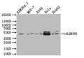 Western Blot
Positive WB detected in:RAW264.7 whole cell lysate, MCF7 whole cell lysate, K549 whole cell lysate, Hela whole cell lysate, HepG2 whole cell lysate
All lanes:ALDH3B1 Antibody at 1:1000
Secondary
Goat polyclonal to rabbit IgG at 1/50000 dilution
Predicted band size: 52kDa
Observed band size: 52 kDa