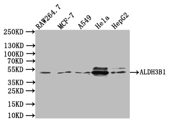Western Blot
Positive WB detected in:RAW264.7 whole cell lysate, MCF7 whole cell lysate, K549 whole cell lysate, Hela whole cell lysate, HepG2 whole cell lysate
All lanes:ALDH3B1 Antibody at 1:1000
Secondary
Goat polyclonal to rabbit IgG at 1/50000 dilution
Predicted band size: 52kDa
Observed band size: 52 kDa