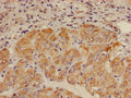 ALDH3B2 Antibody, FITC conjugated – Figure 1 of 2