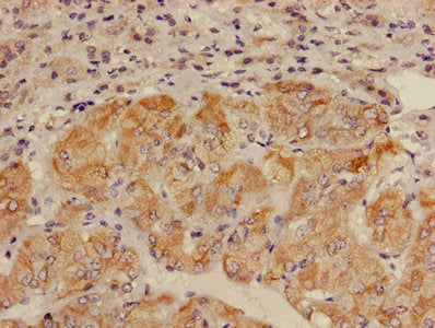 ALDH3B2 Antibody, Biotin conjugated – Figure 1 of 2