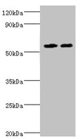Western blot
All lanes: ALDH4A1 antibody at 13µg/ml
Lane 1: K562 whole cell lysate
Lane 2: 293T whole cell lysate
Secondary
Goat polyclonal to rabbit IgG&nbsp;at 1/10000 dilution
Predicted band size: 62, 56, 57 kDa
Observed band size: 62 kDa