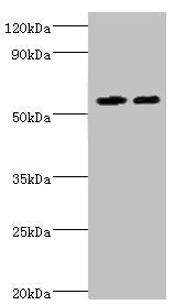 Western blot
All lanes: ALDH4A1 antibody at 13µg/ml
Lane 1: K562 whole cell lysate
Lane 2: 293T whole cell lysate
Secondary
Goat polyclonal to rabbit IgG&nbsp;at 1/10000 dilution
Predicted band size: 62, 56, 57 kDa
Observed band size: 62 kDa