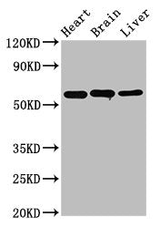 Western Blot
Positive WB detected in: Rat heart tissue, Rat brain tissue, Mouse liver tissue
All lanes: ALDH5A1 antibody at 3.2µg/ml
Secondary
Goat polyclonal to rabbit IgG at 1/50000 dilution
Predicted band size: 58, 59 kDa
Observed band size: 58 kDa