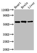 ALDH5A1 Antibody, Biotin conjugated – Figure 1 of 5