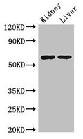 Western Blot
Positive WB detected in: Mouse kidney tissue, Mouse liver tissue
All lanes: ALDH6A1 antibody at 2.5ug/ml
Secondary
Goat polyclonal to rabbit IgG at 1/50000 dilution
Predicted band size: 58, 57 kDa
Observed band size: 58 kDa