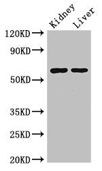 Western Blot
Positive WB detected in: Mouse kidney tissue, Mouse liver tissue
All lanes: ALDH6A1 antibody at 2.5ug/ml
Secondary
Goat polyclonal to rabbit IgG at 1/50000 dilution
Predicted band size: 58, 57 kDa
Observed band size: 58 kDa