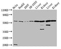 Western Blot
Positive WB detected in: Hela whole cell lysate, HepG2 whole cell lysate, 293T whole cell lysate, SH-SY5Y whole cell lysate, Rat liver tissue, Rat kidney tissue, Mouse liver tissue, Mouse kidney tissue
All lanes: ALDH7A1 antibody at 4.7µg/ml
Secondary
Goat polyclonal to rabbit IgG at 1/50000 dilution
Predicted band size: 59, 56, 52 kDa
Observed band size: 59 kDa