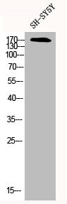 Western Blot analysis of SH-SY5Y cells using CFTR Polyclonal Antibody
