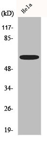 Western Blot analysis of Hela cells using AATF Polyclonal Antibody
