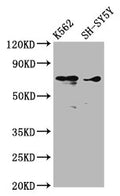 Western Blot
Positive WB detected in: K562 whole cell lysate, SH-SY5Y whole cell lysate
All lanes: ALOX12 antibody at 3.53µg/ml
Secondary
Goat polyclonal to rabbit IgG at 1/50000 dilution
Predicted band size: 76 kDa
Observed band size: 76 kDa