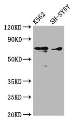 Western Blot
Positive WB detected in: K562 whole cell lysate, SH-SY5Y whole cell lysate
All lanes: ALOX12 antibody at 3.53µg/ml
Secondary
Goat polyclonal to rabbit IgG at 1/50000 dilution
Predicted band size: 76 kDa
Observed band size: 76 kDa