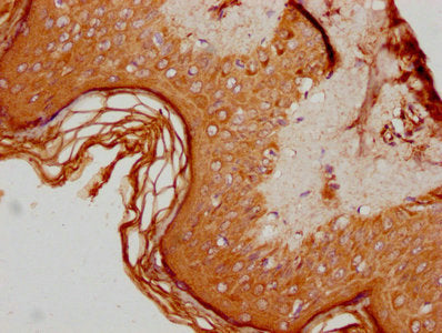 IHC image of CSB-PA001618LA01HU diluted at 1:600 and staining in paraffin-embedded human skin tissue performed on a Leica BondTM system. After dewaxing and hydration, antigen retrieval was mediated by high pressure in a citrate buffer (pH 6.0). Section was blocked with 10% normal goat serum 30min at RT. Then primary antibody (1% BSA) was incubated at 4&deg;C overnight. The primary is detected by a biotinylated secondary antibody and visualized using an HRP conjugated SP system.