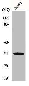 Western Blot analysis of HepG2 cells using Chemokine Receptor D6 Polyclonal Antibody