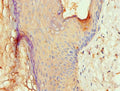 Immunohistochemistry of paraffin-embedded human skin tissue using CSB-PA001622ESR1HU at dilution of 1:100