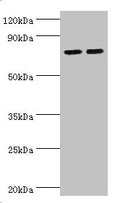 Western blot
All lanes: Arachidonate 15-lipoxygenase B antibody at 11ug/ml
Lane 1: MCF-7 whole cell lysate
Lane 2: 293T whole cell lysate
Secondary
Goat polyclonal to rabbit IgG at 1/10000 dilution
Predicted band size: 76, 68, 70, 73 kDa
Observed band size: 76 kDa