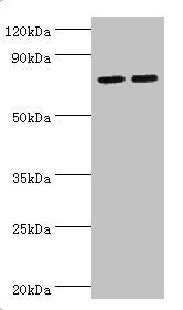 Western blot
All lanes: Arachidonate 15-lipoxygenase B antibody at 11ug/ml
Lane 1: MCF-7 whole cell lysate
Lane 2: 293T whole cell lysate
Secondary
Goat polyclonal to rabbit IgG at 1/10000 dilution
Predicted band size: 76, 68, 70, 73 kDa
Observed band size: 76 kDa