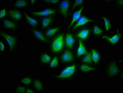 ALOX15B Antibody, Biotin conjugated – Figure 1 of 1