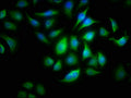 ALOX15B Antibody, HRP conjugated – Figure 1 of 1