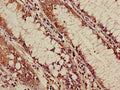 ALOX5 Antibody, HRP conjugated – Figure 1 of 2